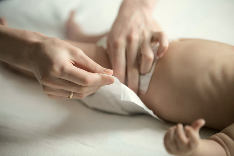 How to Prevent and Treat Diaper Rash
